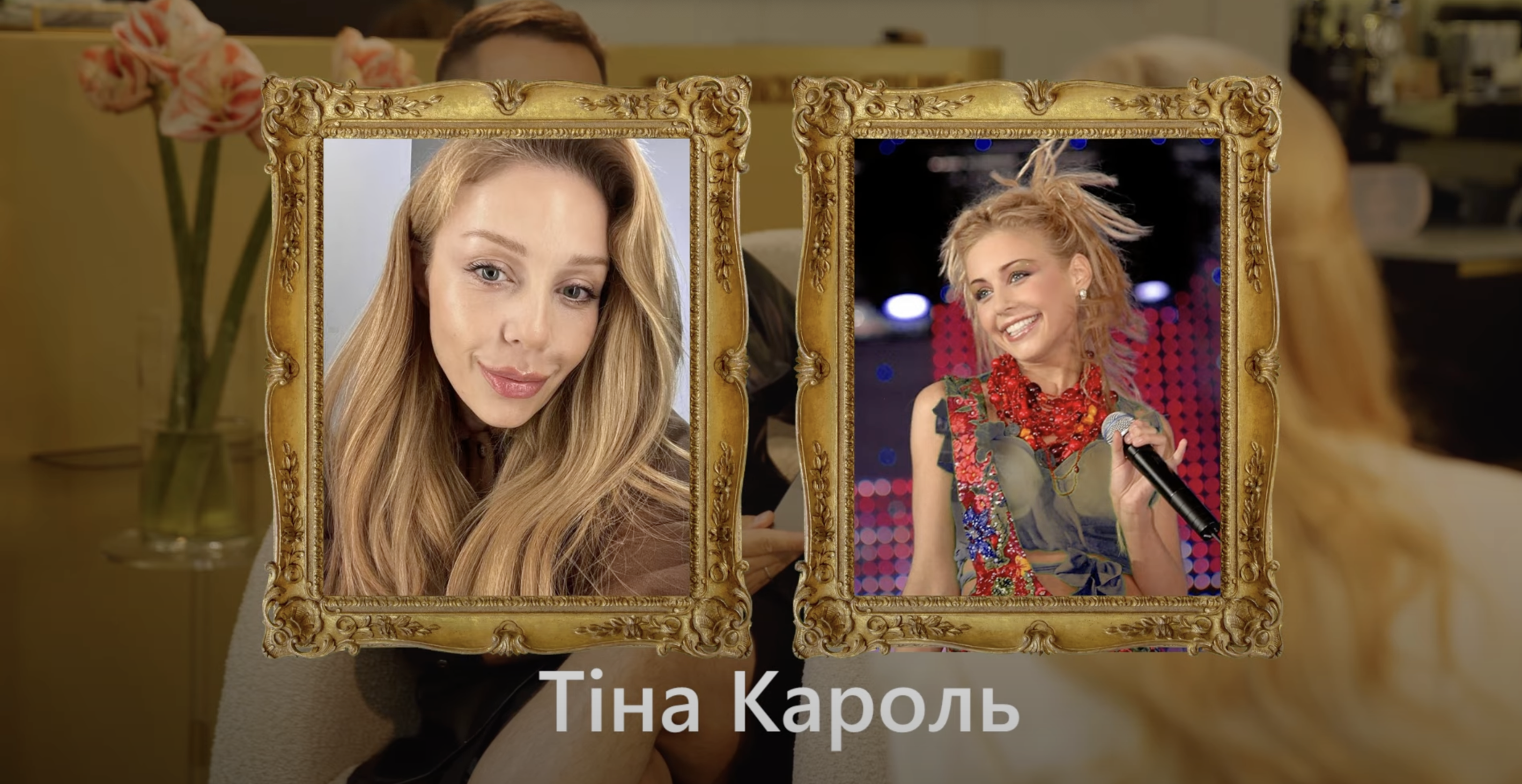 Чи робила Тіна Кароль пластичні операції? Експертка розкрила "рецепт молодості" співачки